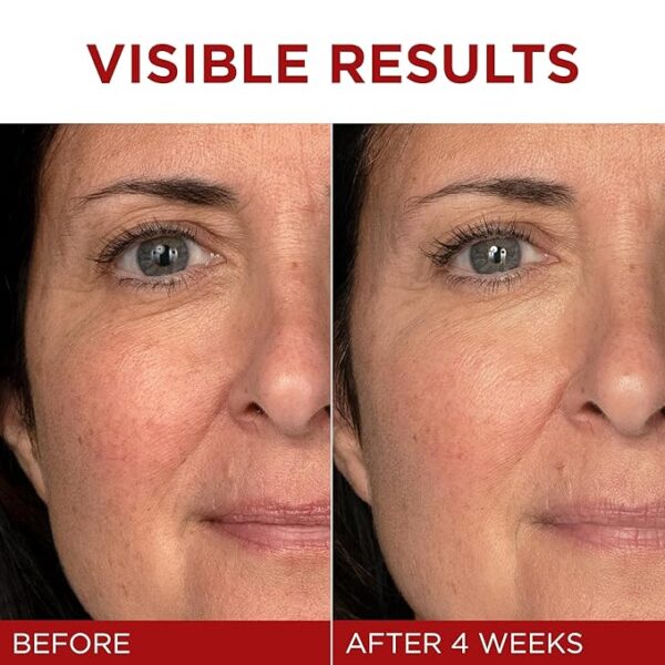 Revitalift Triple Power Anti-Aging Face Moisturizer - Image 4