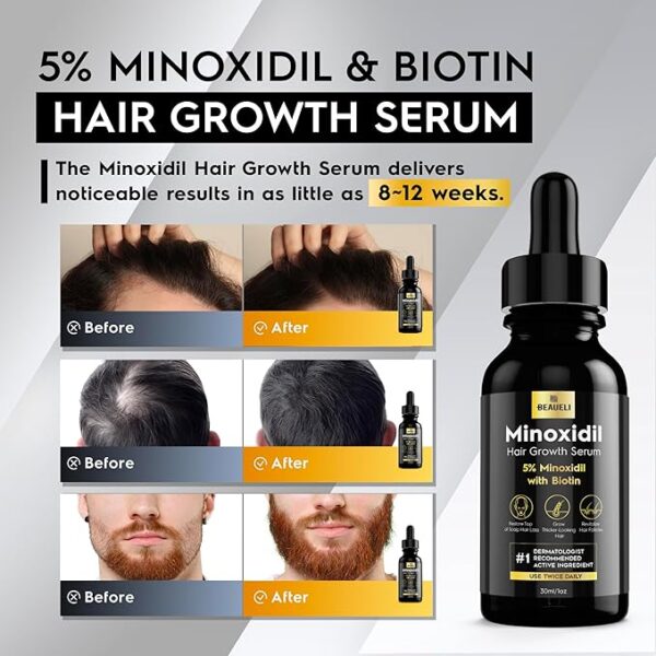 Hair Regrowth Solution Oil for Men and Women - Image 5