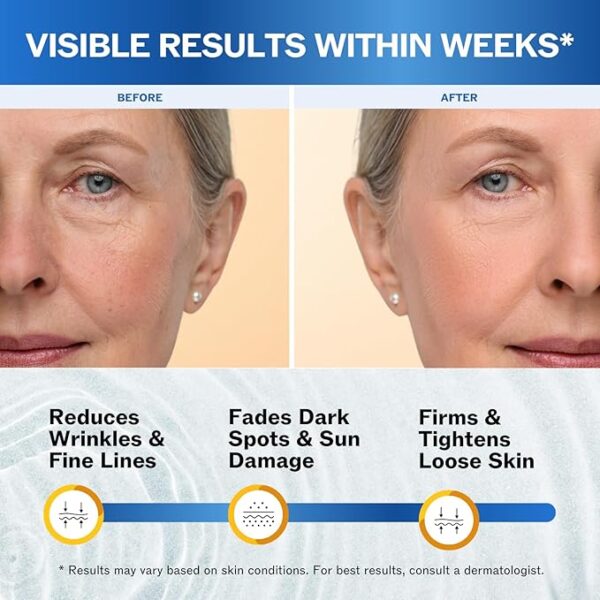 Best Anti-Aging Moisturizer Cream Perfect for All Skin Types - Image 5